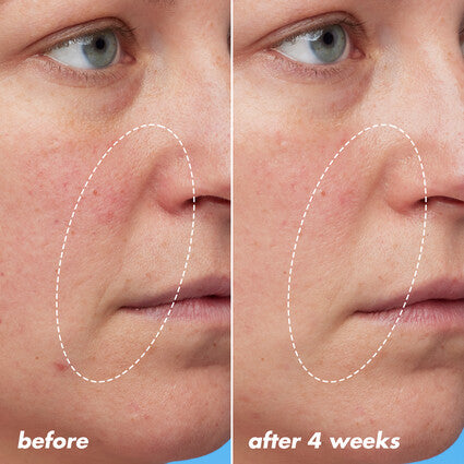 Boosting Blue-ty Sleep Night Oil