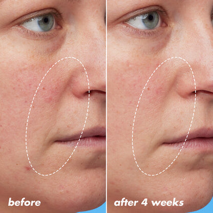 Boosting Blue-ty Sleep Night Oil